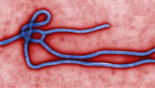 ...तो दुनिया पर मंडरा रहा इबोला वायरस का खतरा!