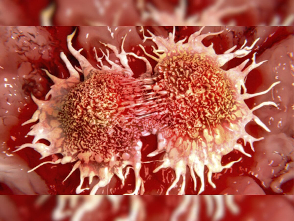 कैंसर कोशिकाओं को खत्म कर सकता है कोलेस्ट्रॉल से लड़ने वाला अणु 