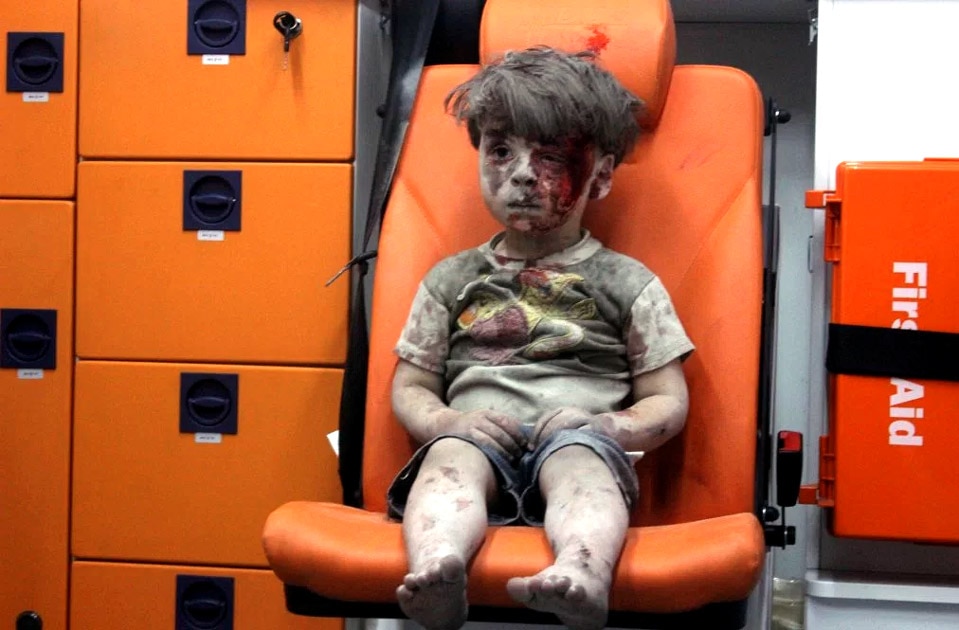 Covered in dust and blood, 5-year-old Omran Daqneesh Covered in dust and blood, 5-year-old Omran Daqneesh
