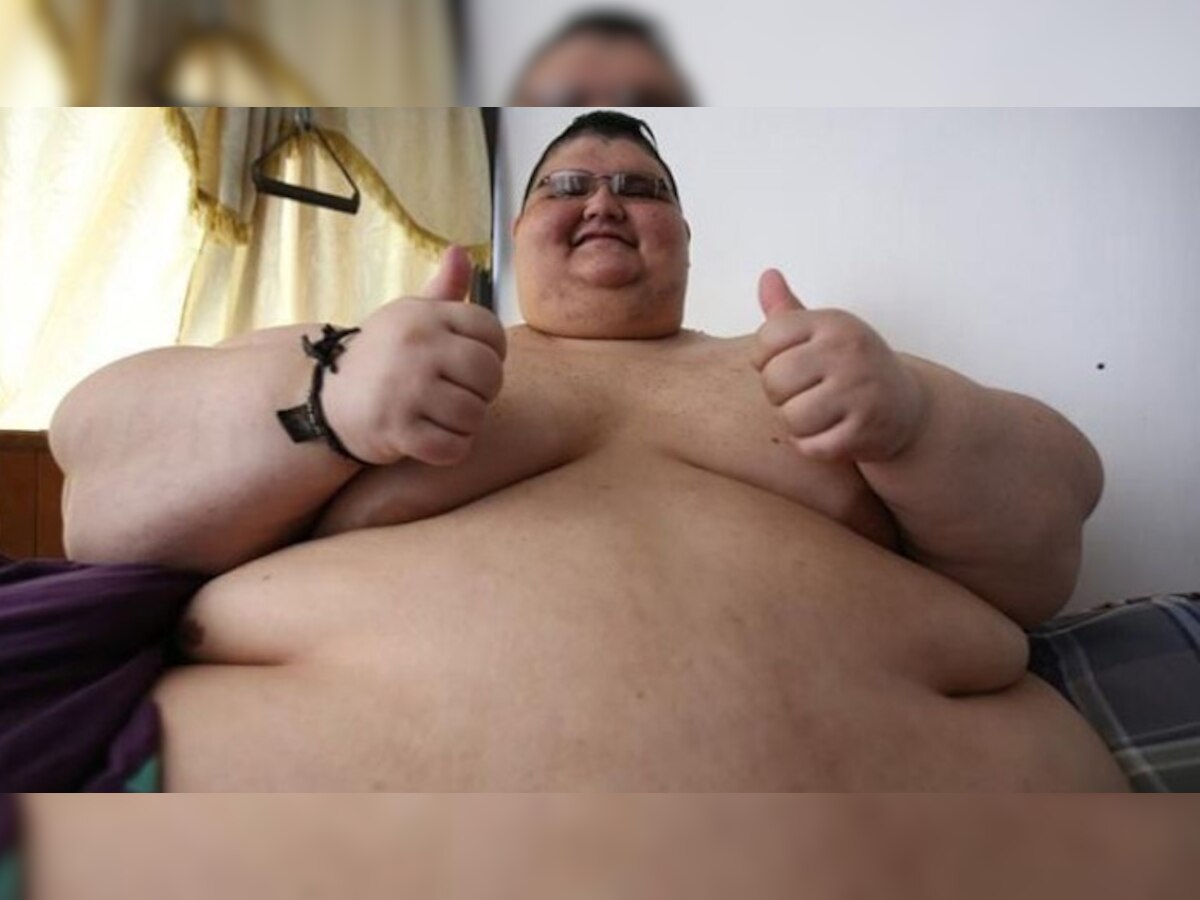 दुनिया के सबसे ज्यादा वजनी व्यक्ति का मोटापा कम करने के लिए उसकी गैस्ट्रिक बाईपास सर्जरी की गई है.(तस्वीर के लिए साभार: EFE)