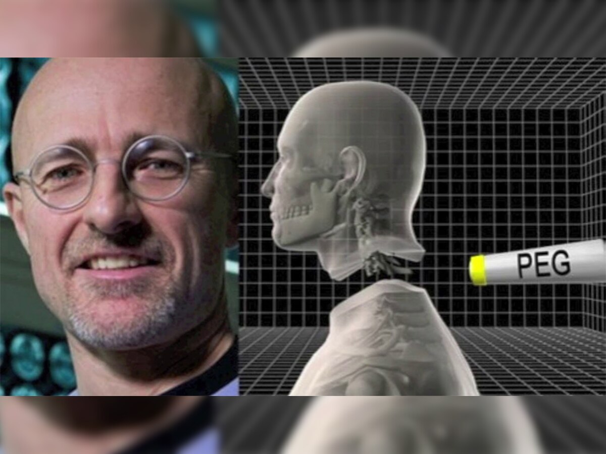 worlds first human head transplant a success बड़ी कामयाबी, 18 घंटे तक