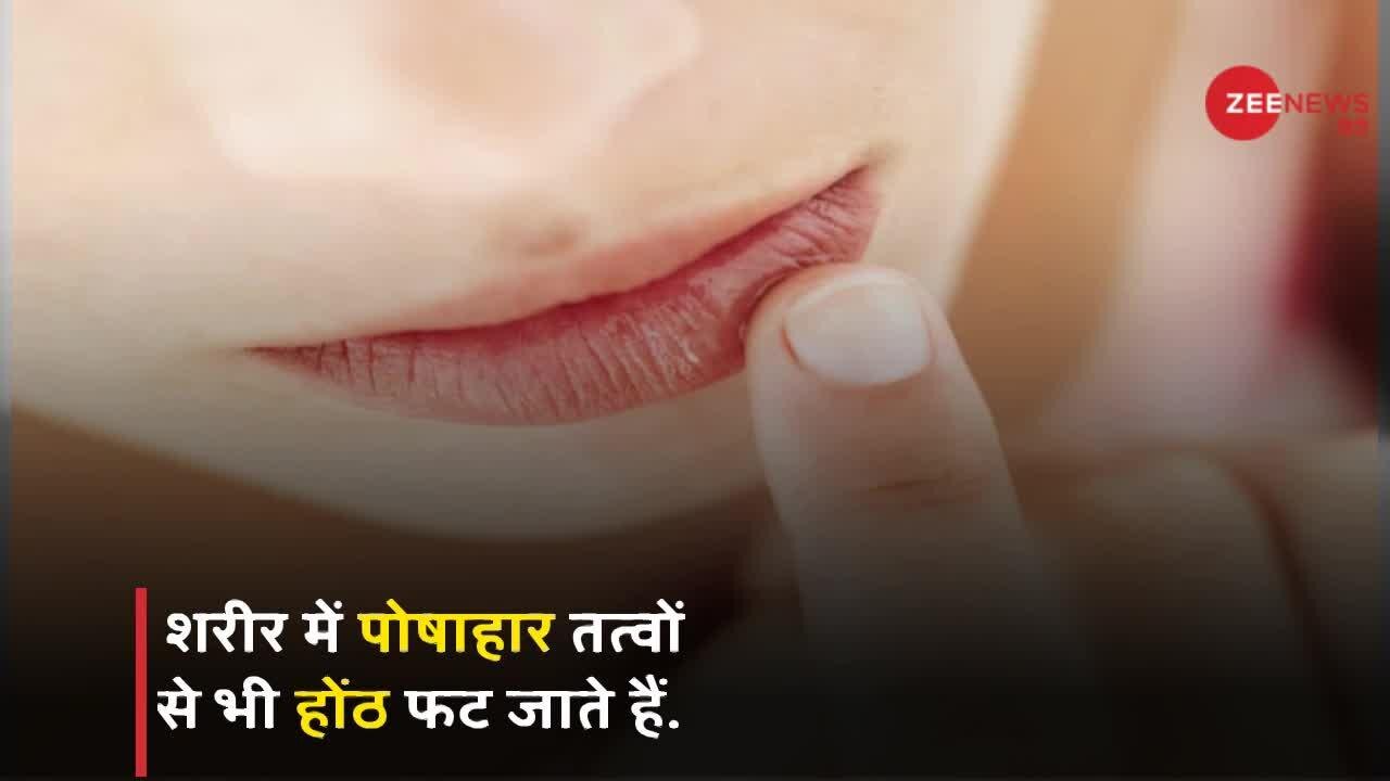 Use these special methods to protect your lip from cracking होंठों को