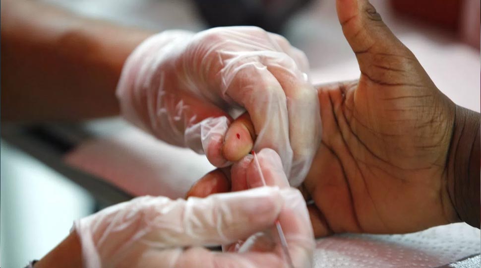 Scrub typhus is dangerous disease Scrub typhus is dangerous disease