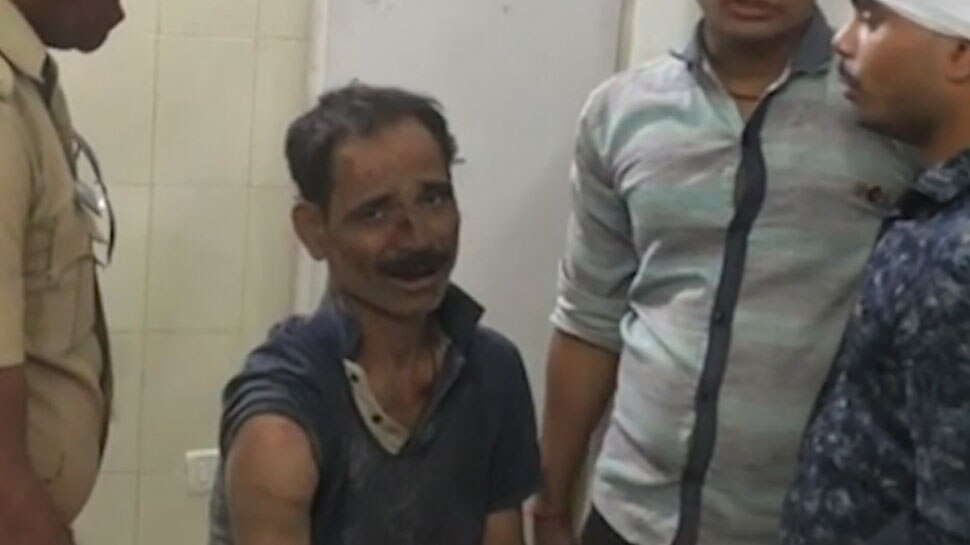 Unnao gangrape how victim father was beaten brutally see pictures Unnao gangrape how victim father was beaten brutally see pictures