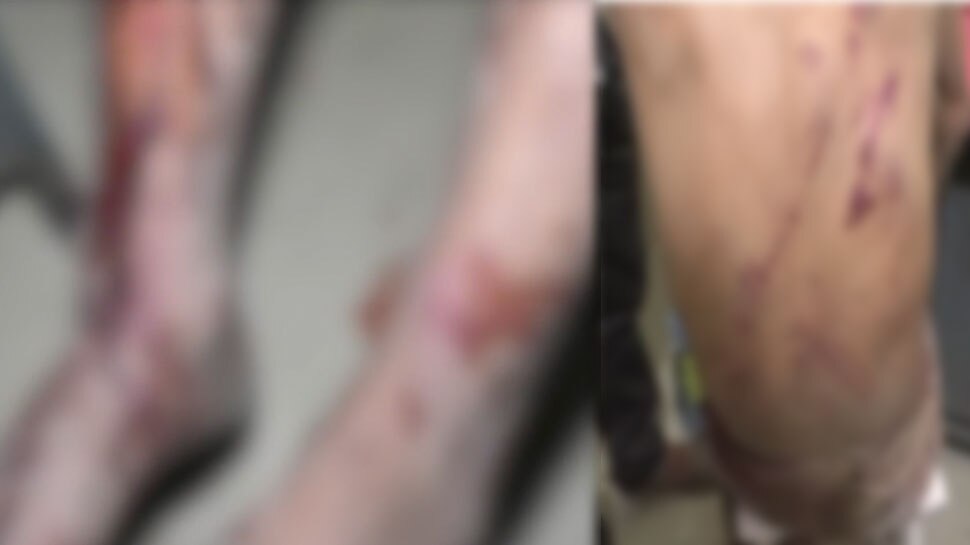 Unnao gangrape how victim father was beaten brutally see pictures Unnao gangrape how victim father was beaten brutally see pictures