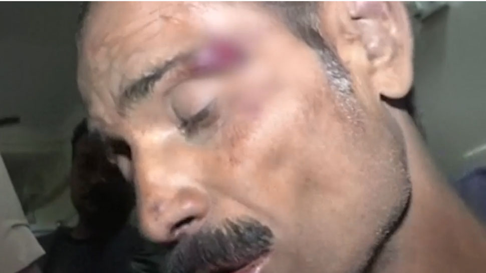 Unnao gangrape how victim father was beaten brutally see pictures Unnao gangrape how victim father was beaten brutally see pictures