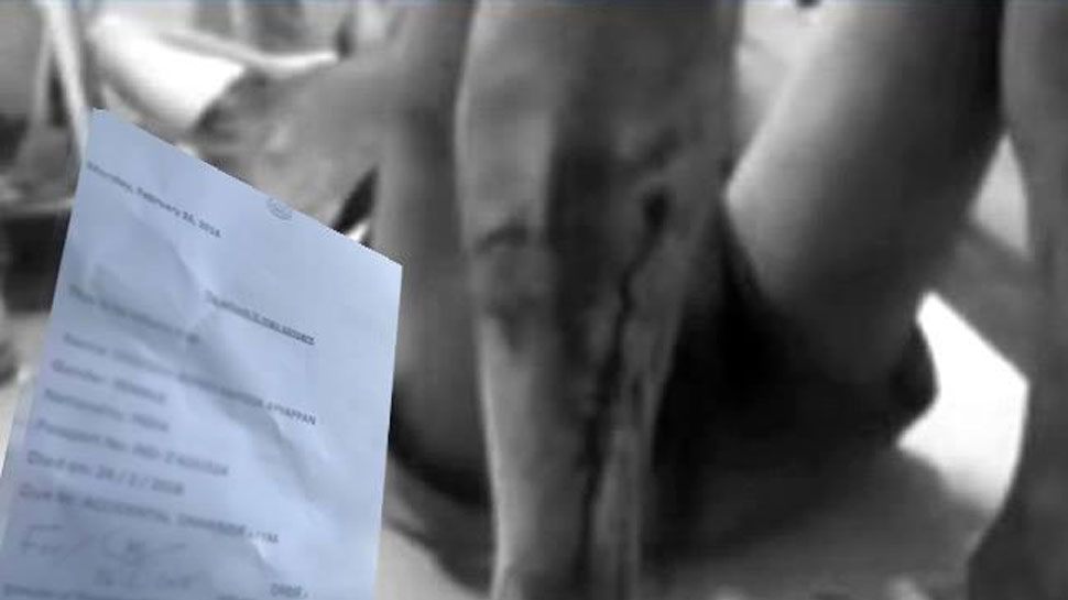 Unnao gangrape how victim father was beaten brutally see pictures Unnao gangrape how victim father was beaten brutally see pictures