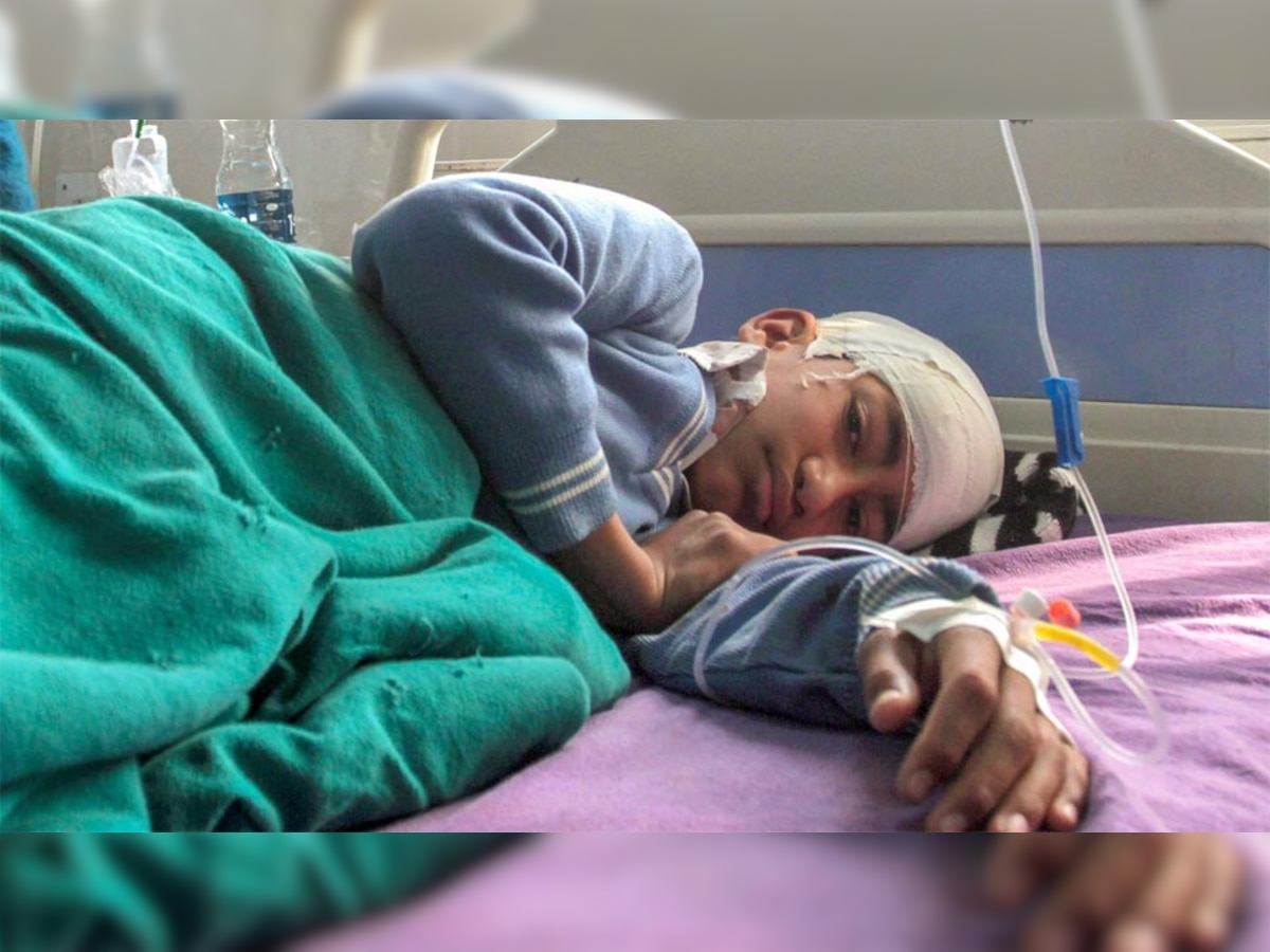 अस्पताल में भर्ती पत्थरबाजी में घायल दूसरी कक्षा का छात्र रिहान गोरसाय. (PTI/2 May, 2018)