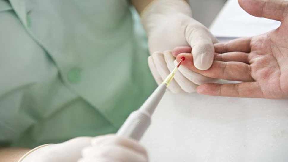 दवाइयों के साथ घरेलू नुस्खे में हैं कारगर Home remedies are effective