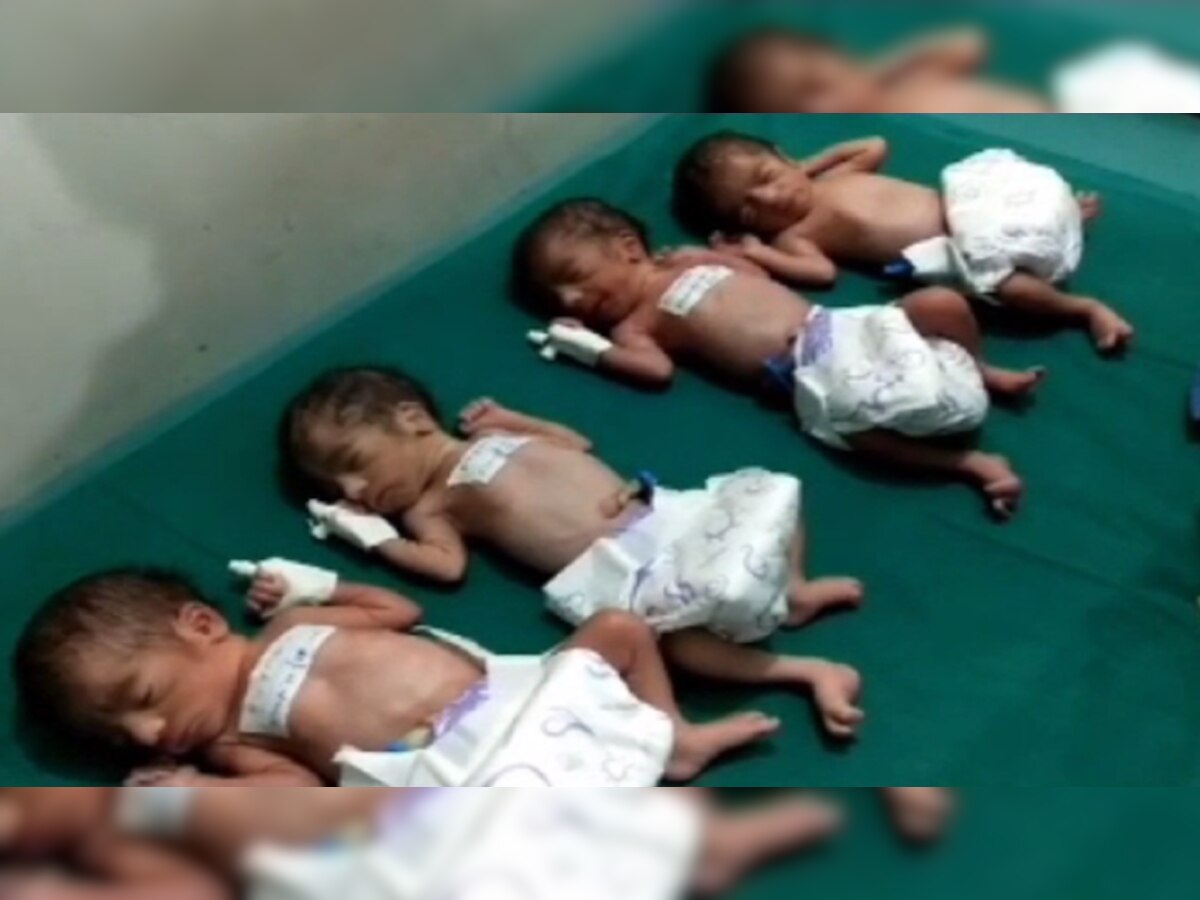 बेगूसराय में महिला ने एक साथ चार बच्चियों को दिया जन्म. 