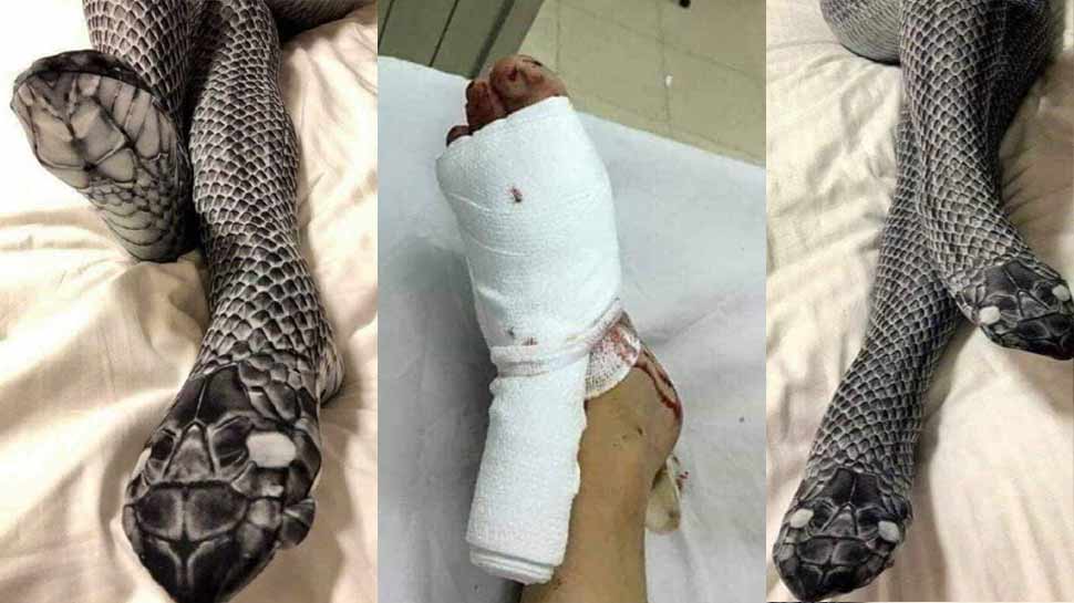 पत्नी की सांप जैसी ड्रेस देखकर भड़क गया पति, बेसबॉल बैट से तोड़ी टांग