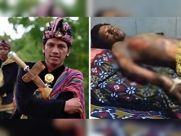 आग से बुरी तरह झुलसे शख्स ने अस्पताल में इलाज के दौरान दम तोड़ दिया. (फोटो साभार: सोशल मीडिया)