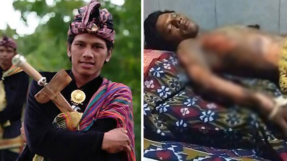 आग से बुरी तरह झुलसे शख्स ने अस्पताल में इलाज के दौरान दम तोड़ दिया. (फोटो साभार: सोशल मीडिया) आग से बुरी तरह झुलसे शख्स ने अस्पताल में इलाज के दौरान दम तोड़ दिया. (फोटो साभार: सोशल मीडिया)