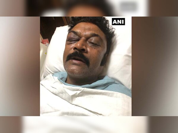 आनंद सिंह ने जेएन गणेश के खिलाफ एफआईआर दर्ज करा दी है. ANI