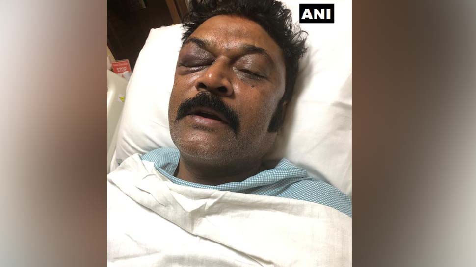 कांग्रेस विधायकों में मारपीट के बाद सामने आई घायल MLA की तस्वीर, गणेश के खिलाफ FIR कांग्रेस विधायकों में मारपीट के बाद सामने आई घायल MLA की तस्वीर, गणेश के खिलाफ FIR
