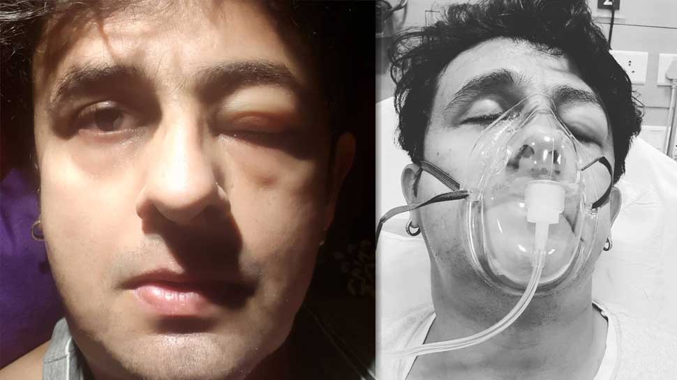 कॉन्सर्ट से लौटते ही सोनू निगम का हुआ ऐसा हाल, वायरल होने लगी तस्वीरें