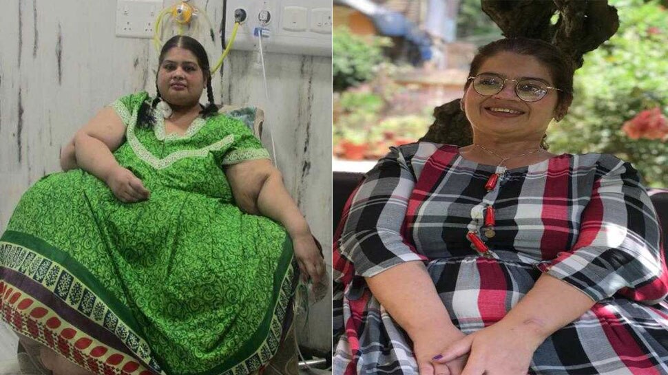 अमिता राजणी का वजन एक समय 300 किलो तक पहुंच गया था. obesity, Amita Rajani