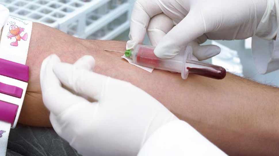 अब सिर्फ 50 रुपये में होगा 10 हजार वाला यह टेस्ट, ICMR को बड़ी कामयाबी अब सिर्फ 50 रुपये में होगा 10 हजार वाला यह टेस्ट, ICMR को बड़ी कामयाबी