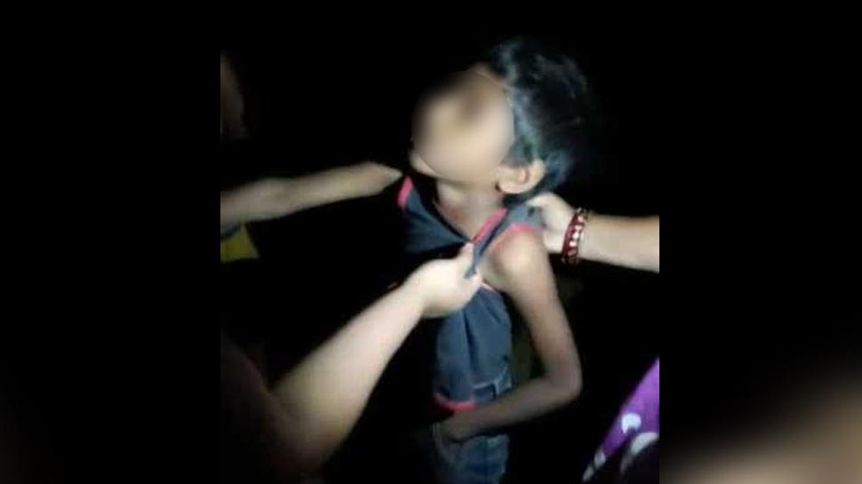 असम: लीची चोरी के आरोप में 5 लोगों ने 8 वर्षीय बच्चे को बेरहमी से पीटा