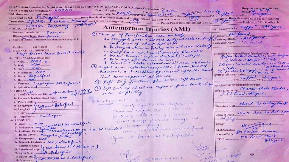 अलीगढ़ हत्या मामला: चौंकाने वाली है मासूम की पोस्टमार्टम रिपोर्ट, 3-4 दिन पहले हुई थी हत्या अलीगढ़ हत्या मामला: चौंकाने वाली है मासूम की पोस्टमार्टम रिपोर्ट, 3-4 दिन पहले हुई थी हत्या