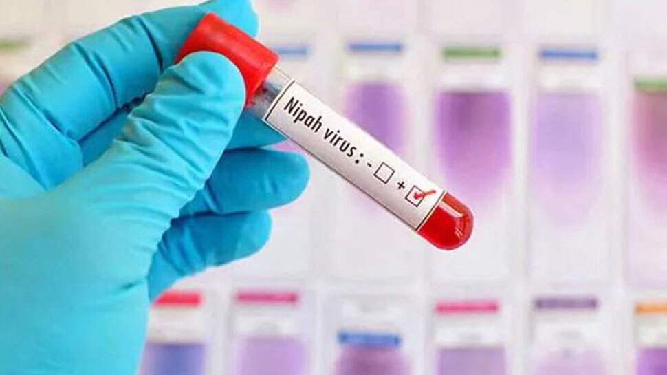 मध्य प्रदेश के गुना, ग्वालियर में निपाह वायरस का खतरा, स्वास्थ्य विभाग ने जारी की एडवाइजरी