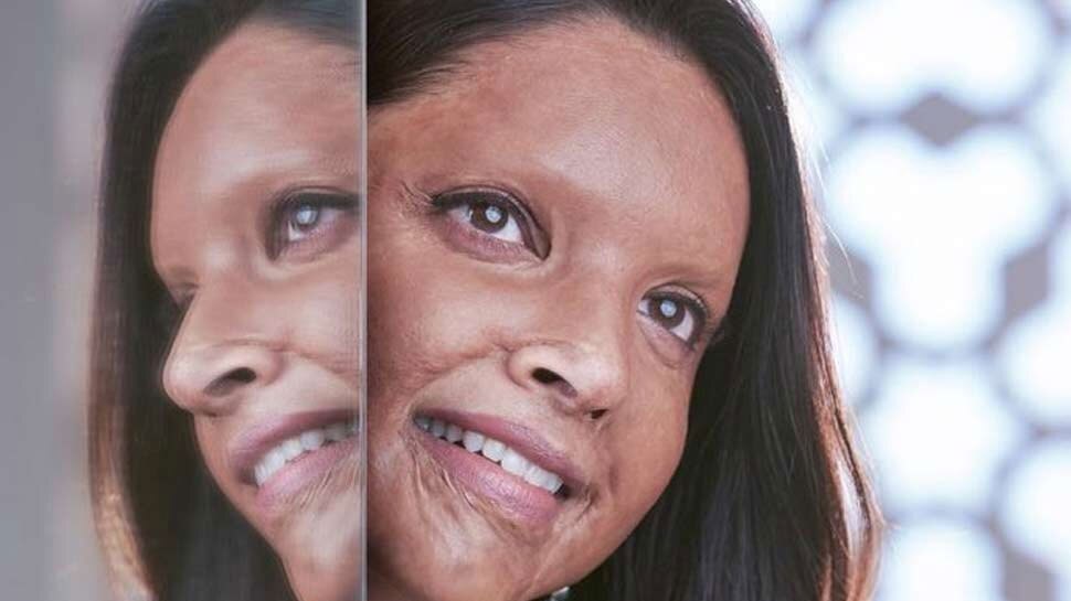 दीपिका पादुकोण ने इसलिए चुना 'छपाक' का किरदार! तैयारी को लेकर भी किया खुलासा
