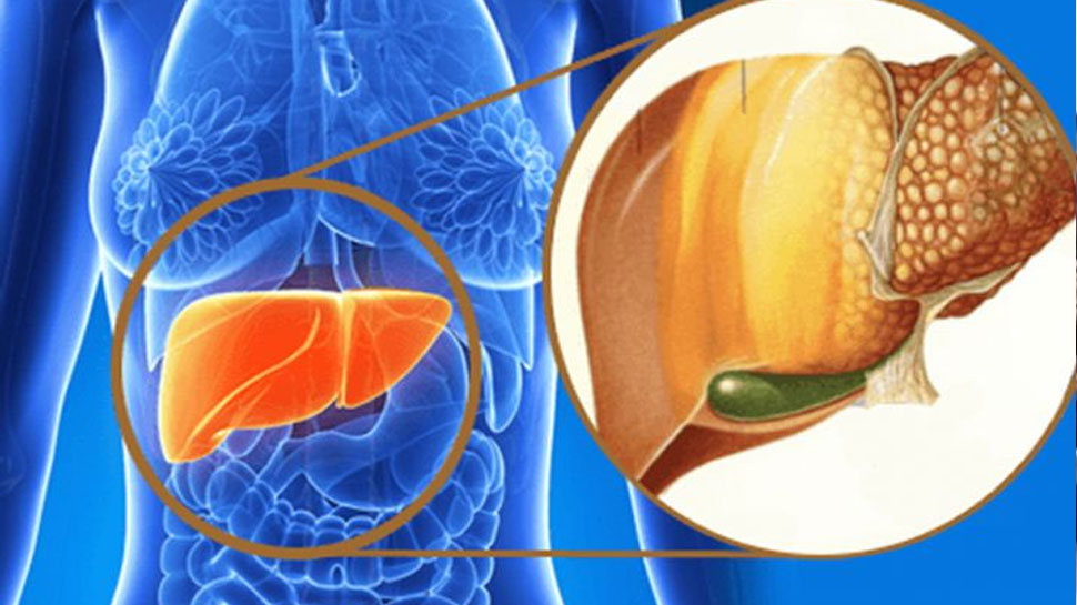 लीवर के स्वास्थ्य के लिए हानिकारक Harmful to the health of the liver