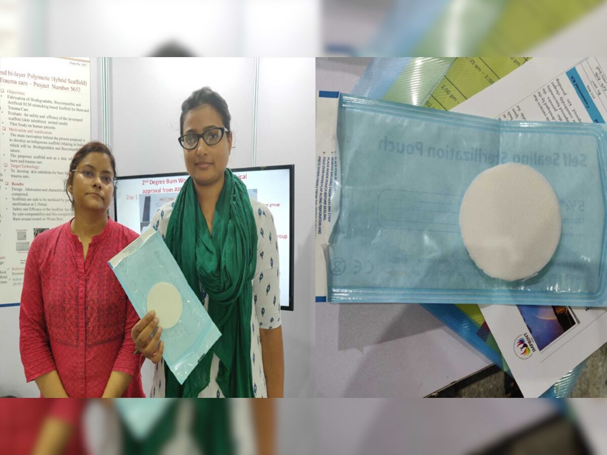 हर साल देशभर में 60 से 70 लाख लोगों को बर्न इंजरी होती है.