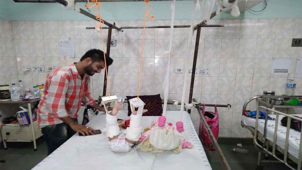 बच्ची को था गुड़िया से बहुत प्यार Fracture in baby's leg