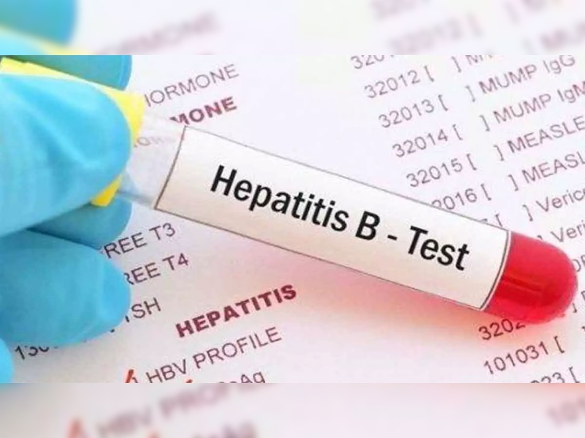 ZEE जानकारी: बेहद खतरनाक है 'हेपेटाइटिस बी' वायरस, जानें इससे कैसे बचा जा सकता है...