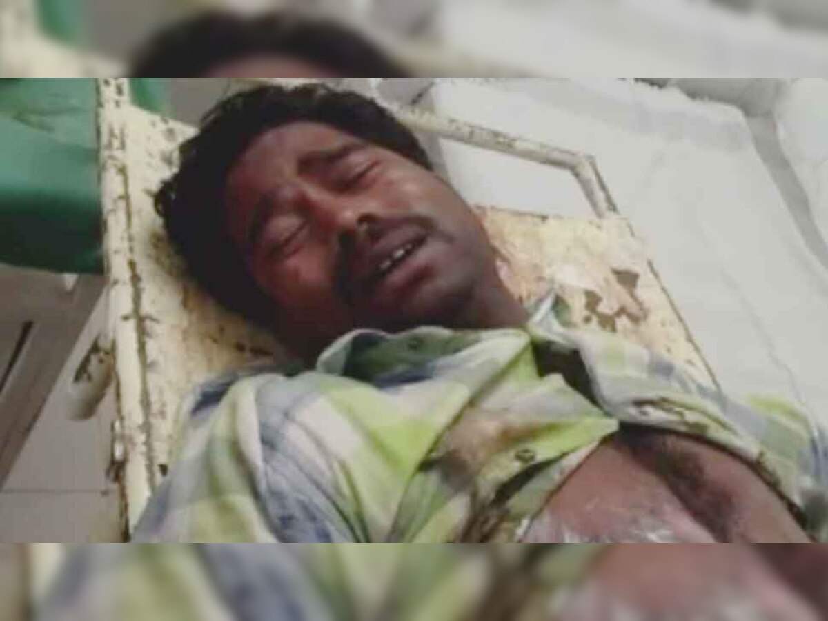 पत्नी और बेटे के लापता होने से परेशान था युवक, थाने पहुंचकर खुद को लगाई आग...