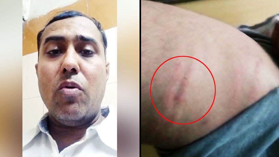 फ्री में खाना मंगा रहे थे ASI साहब, नहीं दिया तो रेस्टोरेंट मैनेजर को बुरी तरह पीटा
