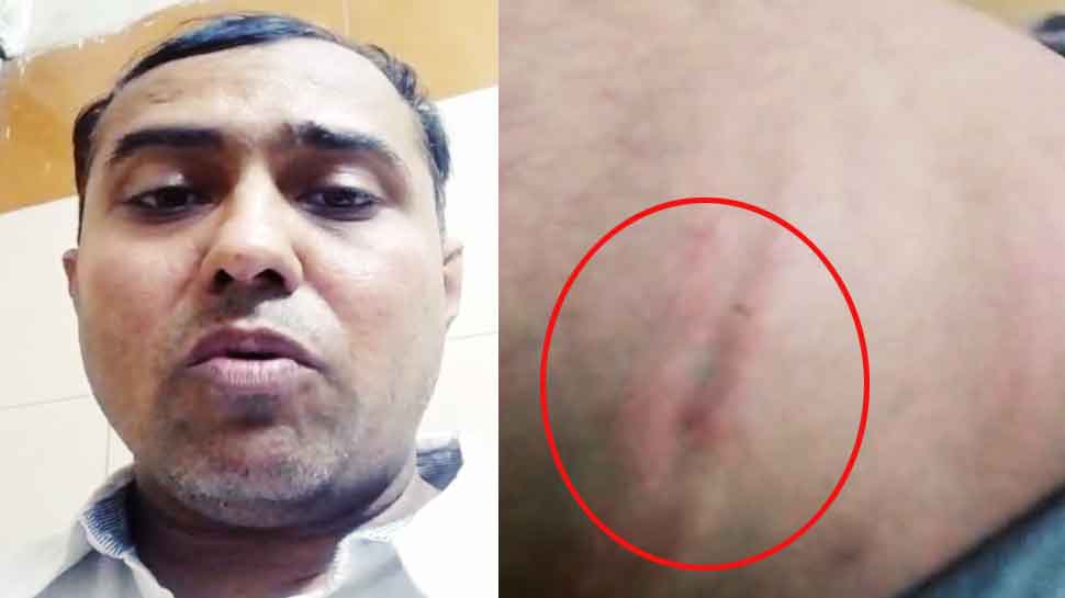 फ्री में खाना मंगा रहे थे ASI साहब, नहीं दिया तो मैनेजर को बुरी तरह पीटा, हो गए सस्पेंड