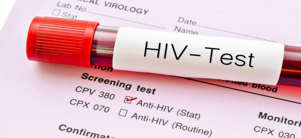 ବାଲେଶ୍ୱରରେ ବ୍ୟାପୁଛି HIV!