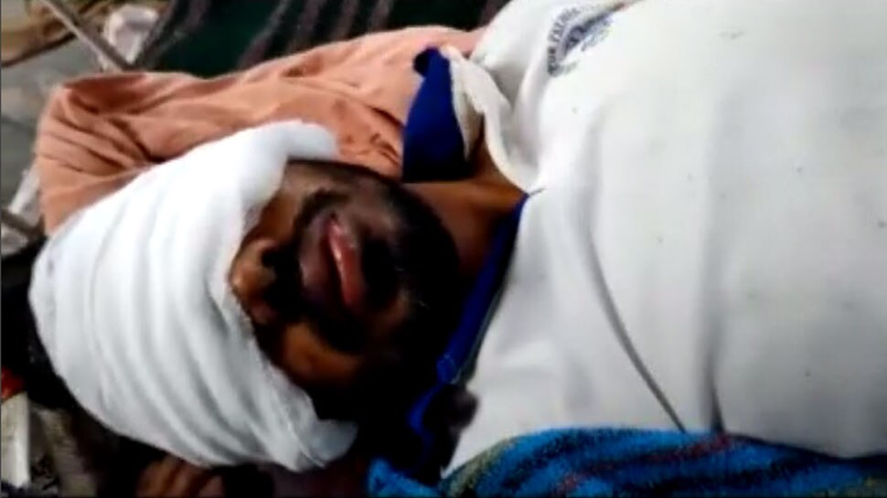 कटक में प्रेमी से इस कदर नाराज हुई प्रेमिका, फेंक दिया चेहरे पर तेजाब