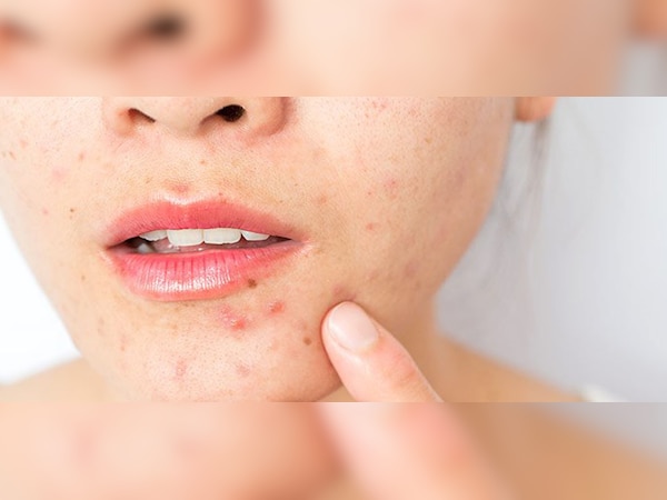 ପ୍ରତୀକାତ୍ମକ ଫଟୋ