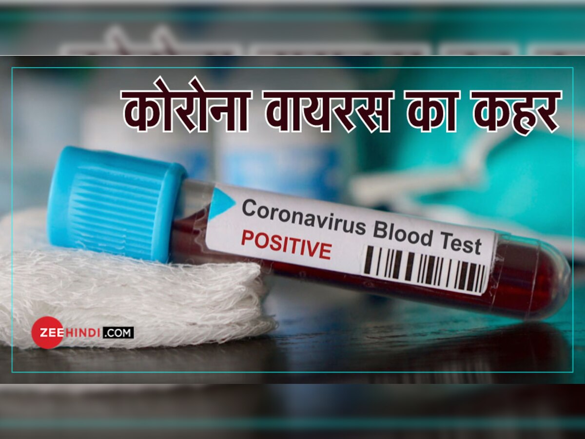 Corona Virus: जान लीजिए क्या है कोरोना वायरस, संक्रमण से बचा सकती है ये खबर