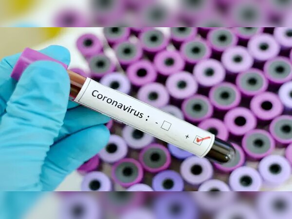 उत्तर प्रदेश में कोरोना मरीजों की तादाद 660 , मरने वालों की तादाद हुई 8