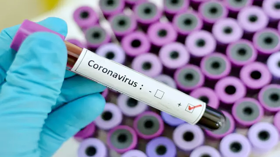 उत्तर प्रदेश में कोरोना मरीजों की तादाद 660 , मरने वालों की तादाद हुई 8 उत्तर प्रदेश में कोरोना मरीजों की तादाद 660 , मरने वालों की तादाद हुई 8