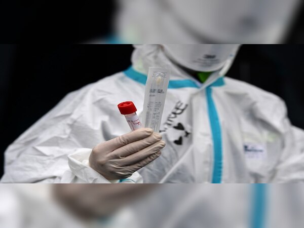 ପ୍ରତୀକାତ୍ମକ ଫଟୋ