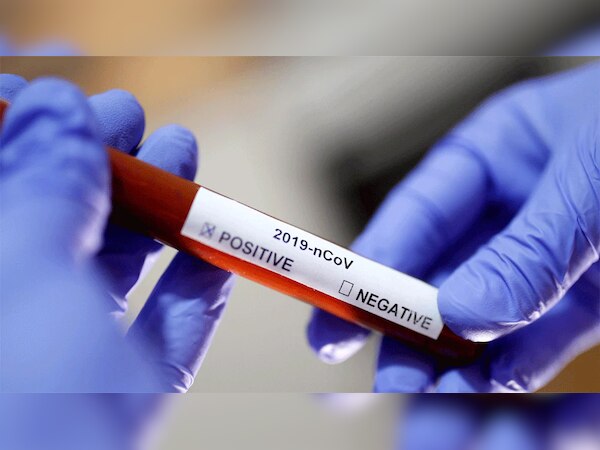 फाइल फोटो...