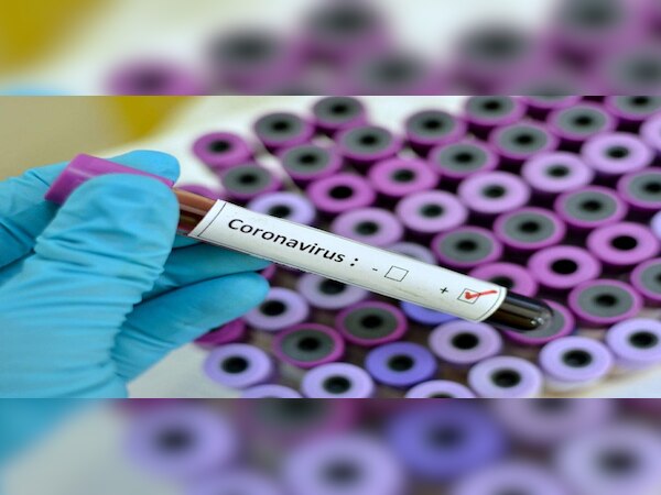 ଆଉ ୧୪୩ କୋରୋନା ଆକ୍ରାନ୍ତ ଚିହ୍ନଟ