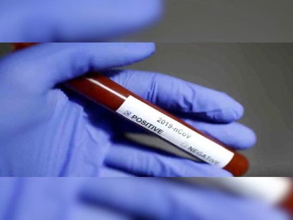 ଦିନକରେ ପାଖାପାଖି ୧୦ ହଜାର ଆକ୍ରାନ୍ତ ଚିହ୍ନଟ