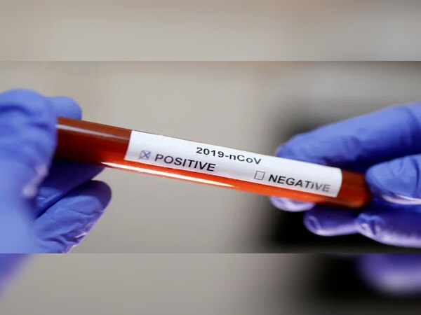 ଜୟପୁର ପହଞ୍ଚିଥିବା ମହିଳାଙ୍କ ଷ୍ଟେସନରେ ମୃତ୍ୟୁ, ୯୦ ଯାତ୍ରୀଙ୍କୁ ପଠାଗଲା ଆଇସୋଲେଶନ