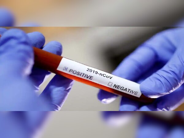 ପ୍ରତୀକାତ୍ମକ ଫଟୋ