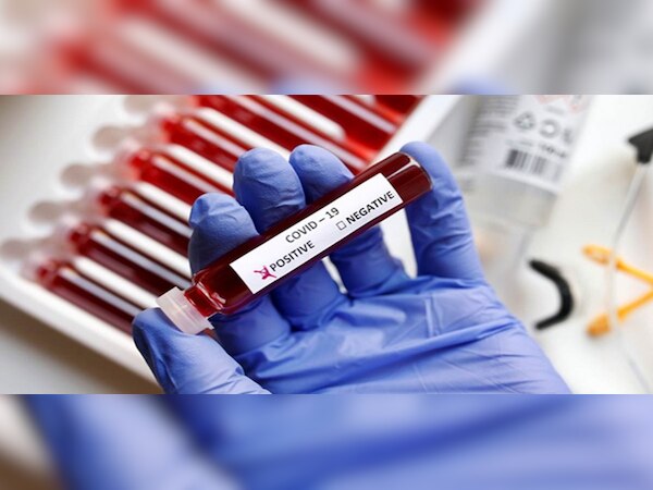 ପ୍ରତୀକାତ୍ମକ ଫଟୋ