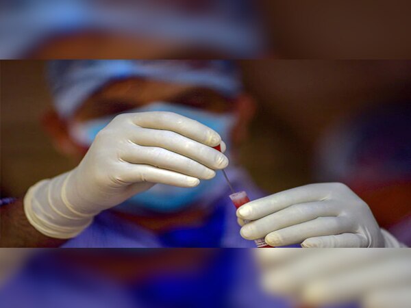 ଘରୋଇ ଲ୍ୟାବରେ କୋଭିଡ ଟେଷ୍ଟର ମୂଲ୍ୟ ହ୍ରାସ କଲେ ମହାରାଷ୍ଟ୍ର ସରକାର 