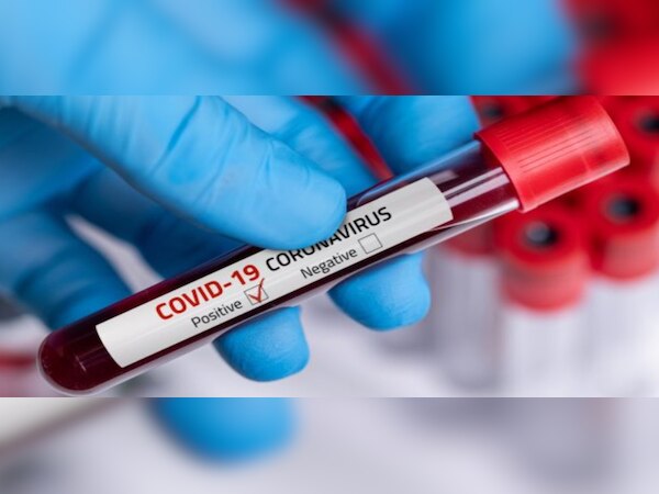 ପ୍ରତୀକାତ୍ମକ ଫଟୋ