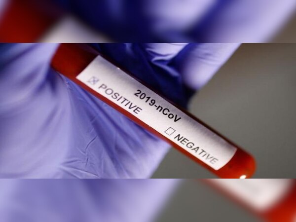 ରାଜ୍ୟରେ ସୁସ୍ଥ ହେଲେଣି ୩ ହଜାରରୁ ଉର୍ଦ୍ଧ୍ୱ କୋରୋନା ଆକ୍ରାନ୍ତ