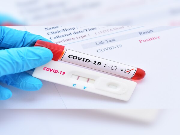 ପୁରୀରେ ଆରମ୍ଭ ହେଲା ସେରୋଲଜିକାଲ ଟେଷ୍ଟ